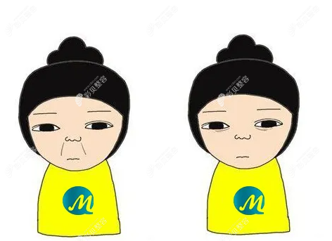 去正规医疗机构注射玻尿酸去法令纹