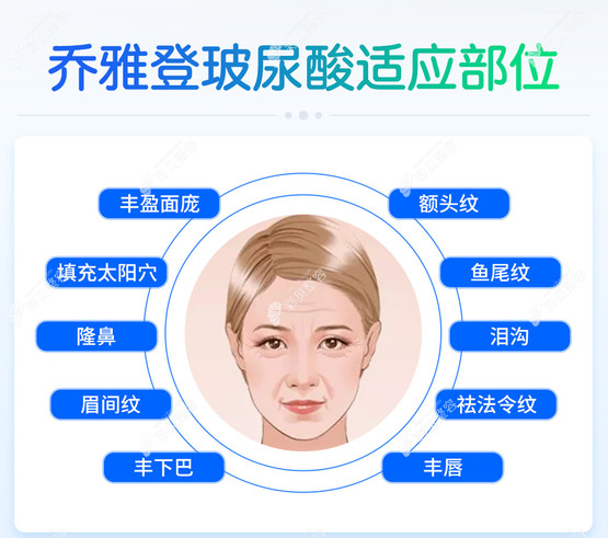 去法令纹应打哪种玻尿酸